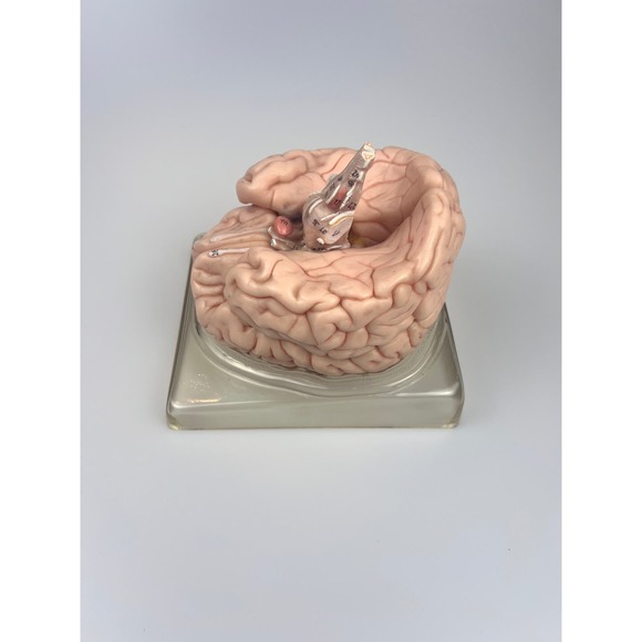 Vintage Somso Germany Anatomical Teaching Model | Human Brain | 6 Parts | Oddity - Picture 4 of 9